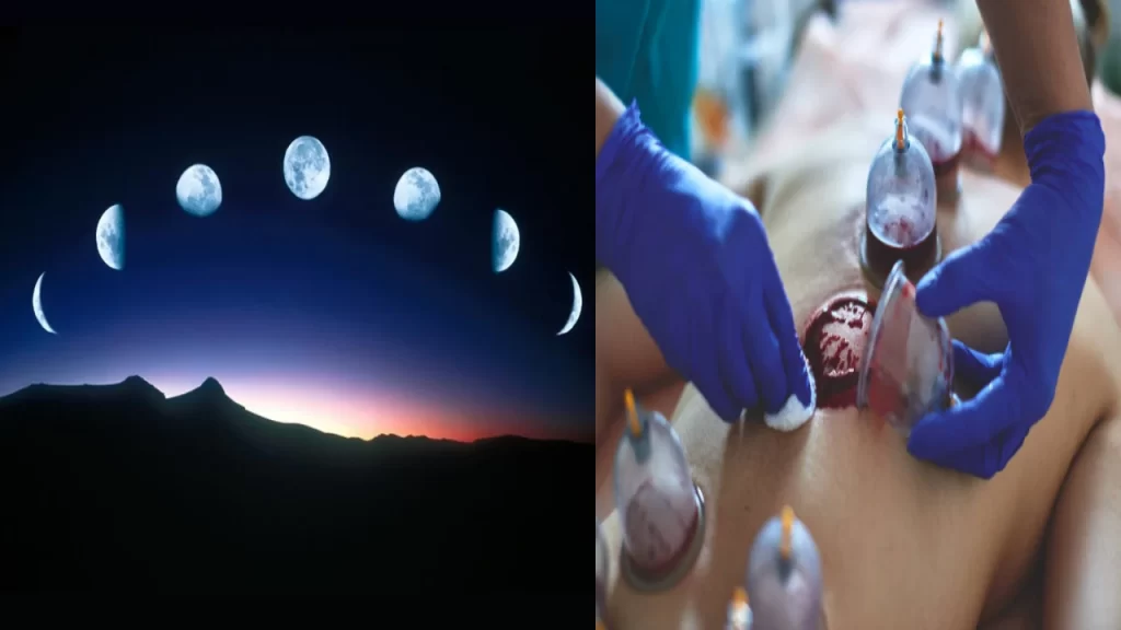Moon and Hijama