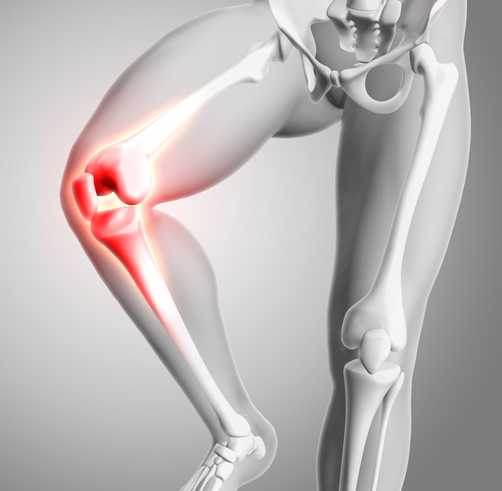 Top 5 Causes of Knee Pain | Dartmouth & Bedford